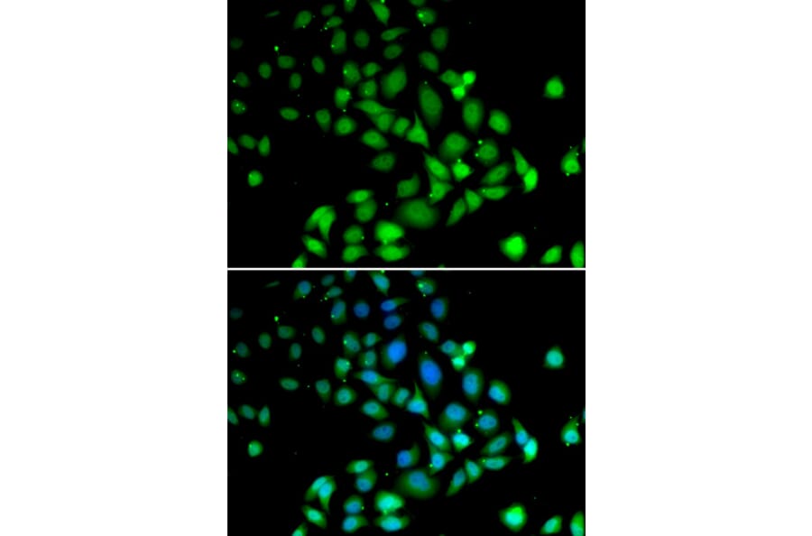 Immunofluorescence - Anti-PARN Antibody (A91413) - Antibodies.com