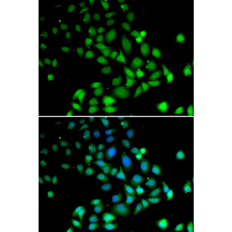 Immunofluorescence - Anti-PARN Antibody (A91413) - Antibodies.com