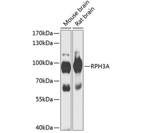 Western Blot - Anti-Rabphilin 3A Antibody (A91415) - Antibodies.com