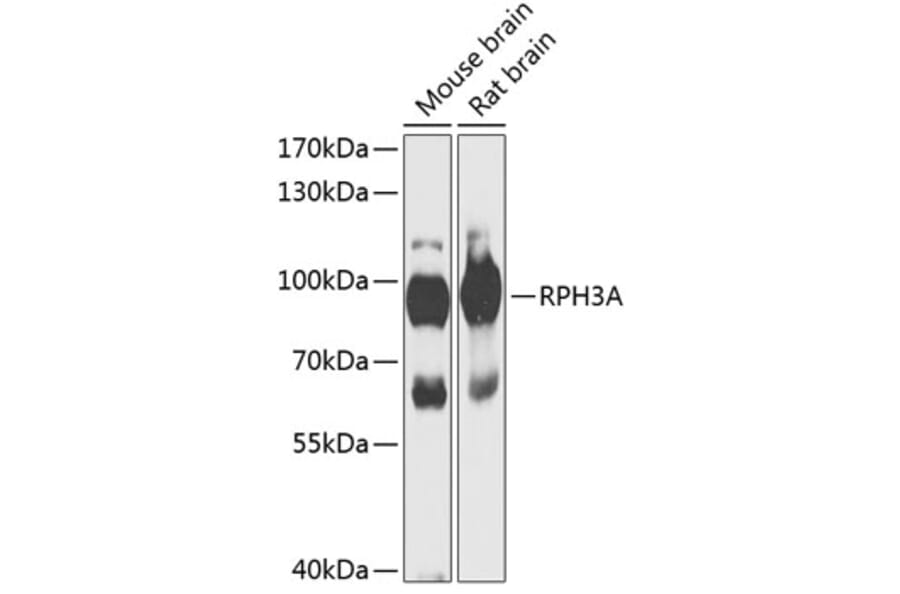 Western Blot - Anti-Rabphilin 3A Antibody (A91415) - Antibodies.com