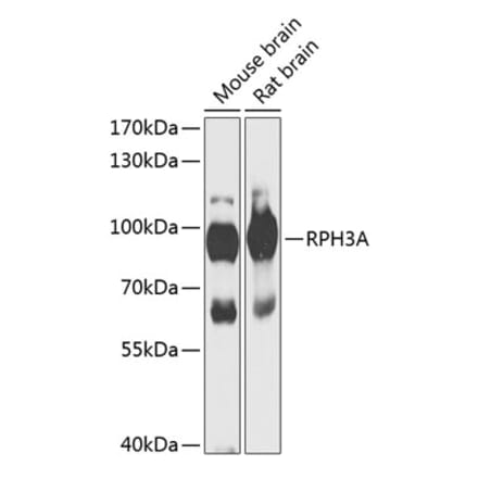 Western Blot - Anti-Rabphilin 3A Antibody (A91415) - Antibodies.com