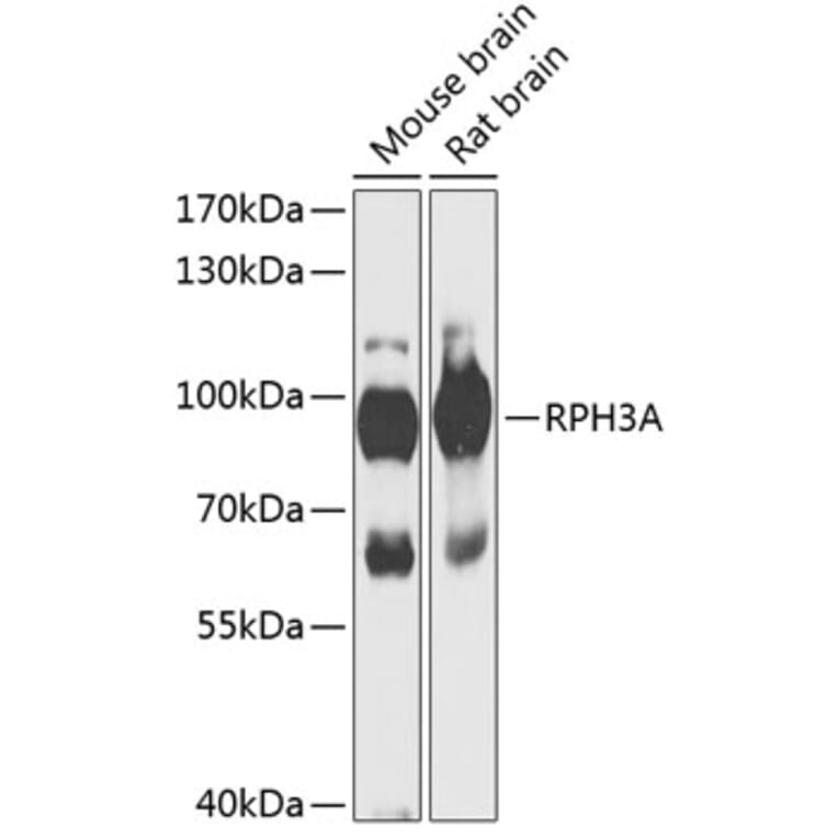 Western Blot - Anti-Rabphilin 3A Antibody (A91415) - Antibodies.com