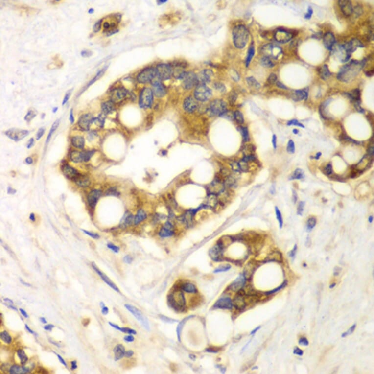 Immunohistochemistry - Anti-Rabphilin 3A Antibody (A91415) - Antibodies.com