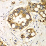 Immunohistochemistry - Anti-Rabphilin 3A Antibody (A91415) - Antibodies.com