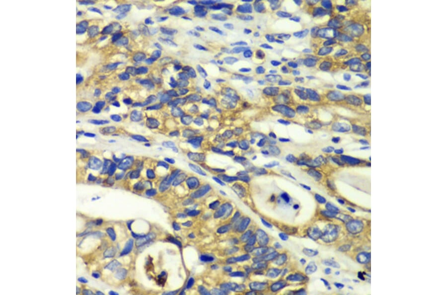 Immunohistochemistry - Anti-Rabphilin 3A Antibody (A91415) - Antibodies.com
