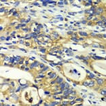 Immunohistochemistry - Anti-Rabphilin 3A Antibody (A91415) - Antibodies.com