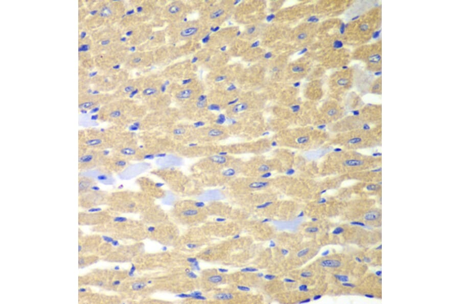 Immunohistochemistry - Anti-Rabphilin 3A Antibody (A91415) - Antibodies.com