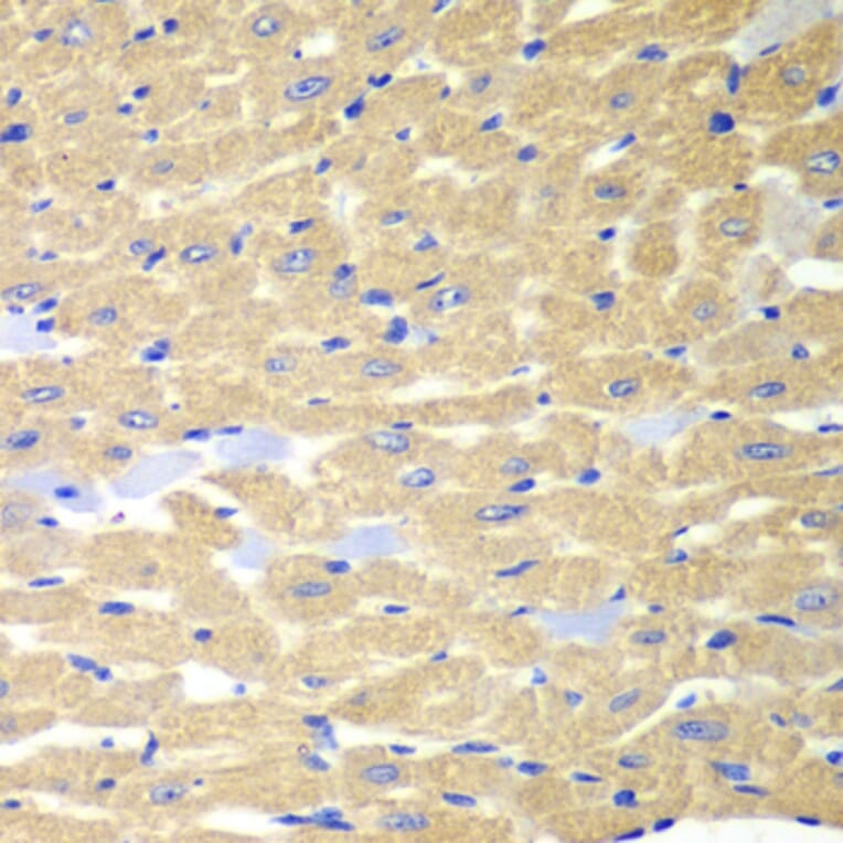 Immunohistochemistry - Anti-Rabphilin 3A Antibody (A91415) - Antibodies.com
