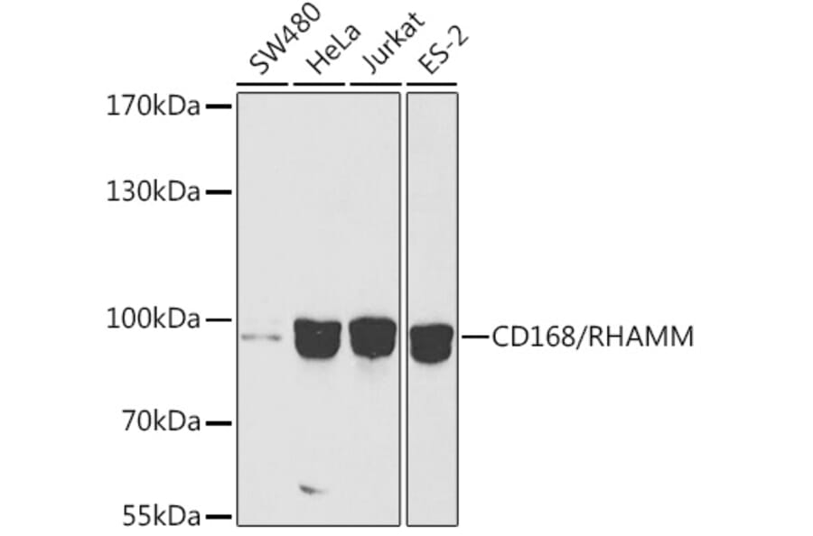Western Blot - Anti-CD168 Antibody (A91416) - Antibodies.com