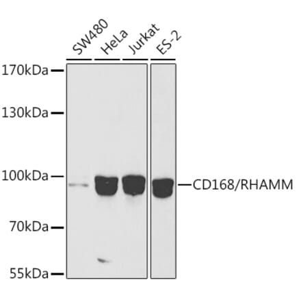 Western Blot - Anti-CD168 Antibody (A91416) - Antibodies.com