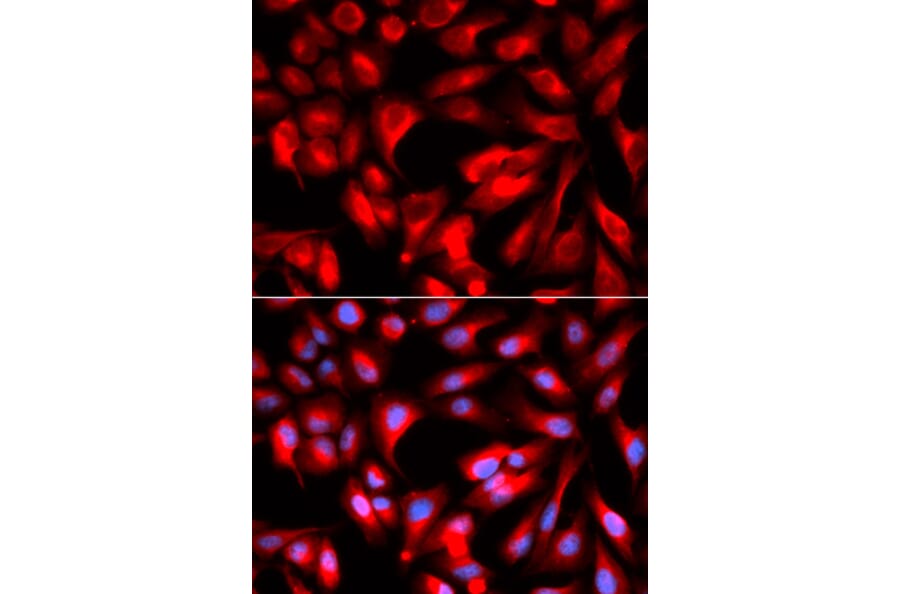 Immunofluorescence - Anti-CD168 Antibody (A91416) - Antibodies.com