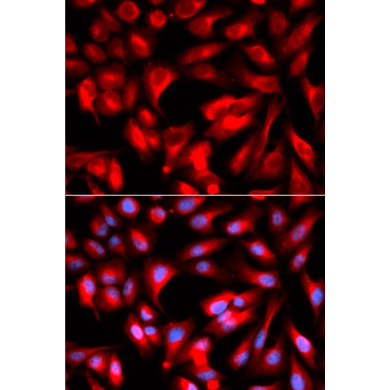Immunofluorescence - Anti-CD168 Antibody (A91416) - Antibodies.com