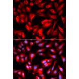 Immunofluorescence - Anti-CD168 Antibody (A91416) - Antibodies.com