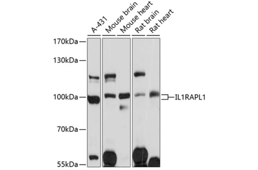 Western Blot - Anti-IL-1RAPL1 Antibody (A91417) - Antibodies.com
