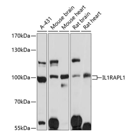 Western Blot - Anti-IL-1RAPL1 Antibody (A91417) - Antibodies.com