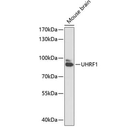 Western Blot - Anti-UHRF1 Antibody (A91418) - Antibodies.com