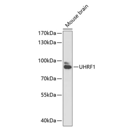 Western Blot - Anti-UHRF1 Antibody (A91418) - Antibodies.com