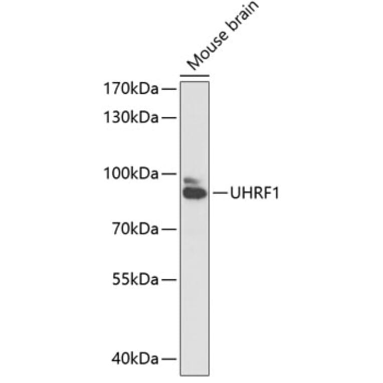 Western Blot - Anti-UHRF1 Antibody (A91418) - Antibodies.com
