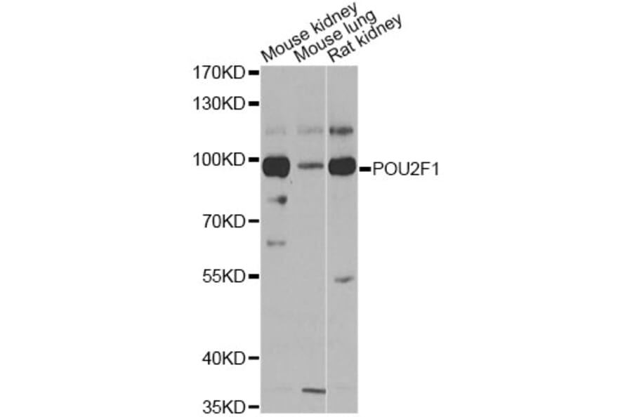 Western Blot - Anti-POU2F1 Antibody (A13527) - Antibodies.com