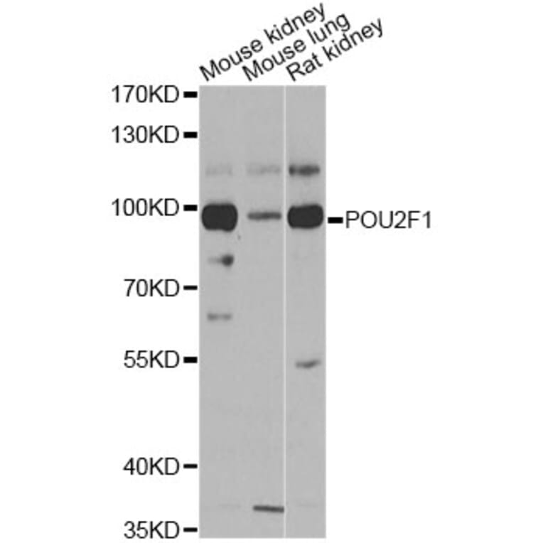 Western Blot - Anti-POU2F1 Antibody (A13527) - Antibodies.com