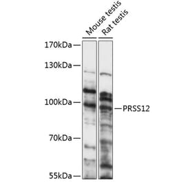 Western Blot - Anti-Neurotrypsin Antibody (A91420) - Antibodies.com