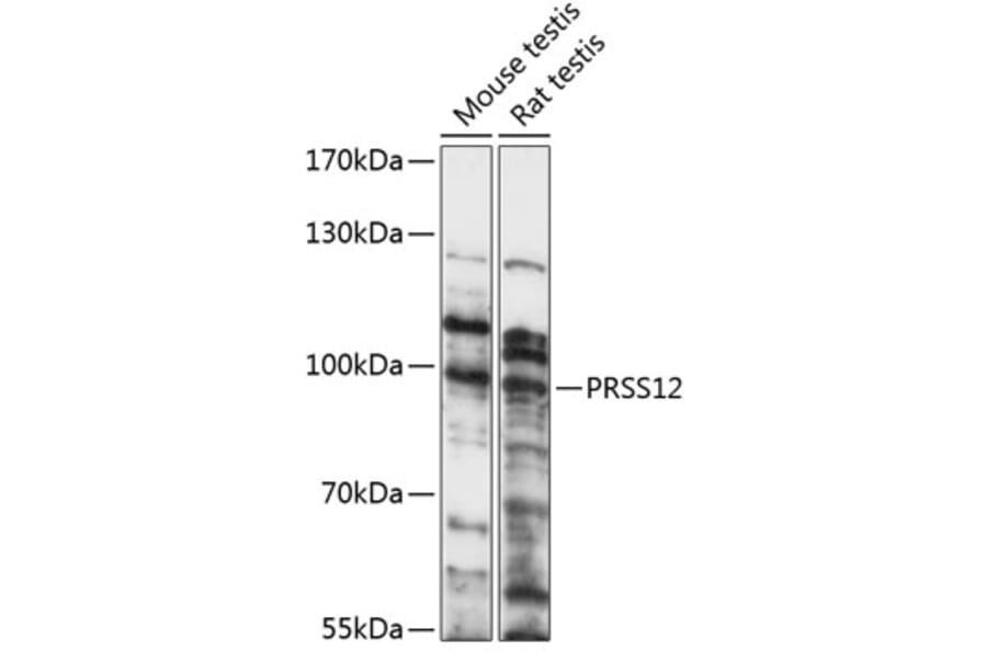 Western Blot - Anti-Neurotrypsin Antibody (A91420) - Antibodies.com