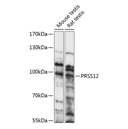 Western Blot - Anti-Neurotrypsin Antibody (A91420) - Antibodies.com