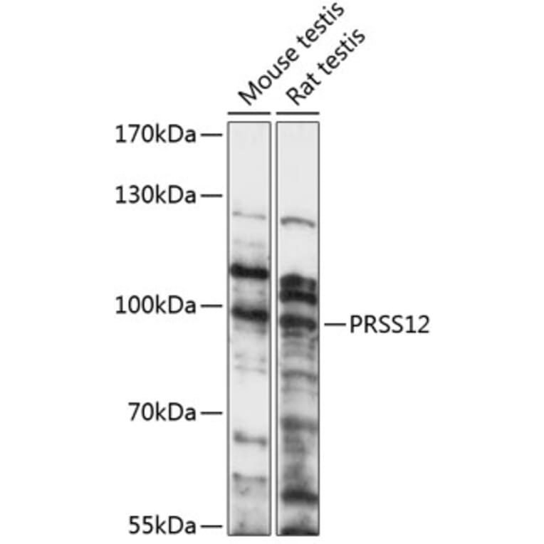Western Blot - Anti-Neurotrypsin Antibody (A91420) - Antibodies.com