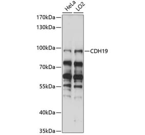Western Blot - Anti-CDH19 Antibody (A91422) - Antibodies.com