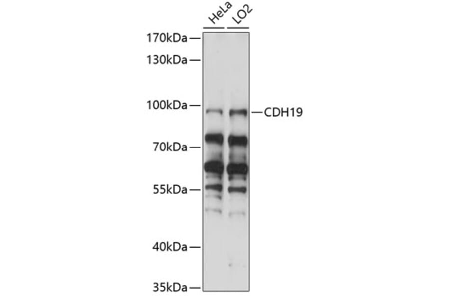 Western Blot - Anti-CDH19 Antibody (A91422) - Antibodies.com