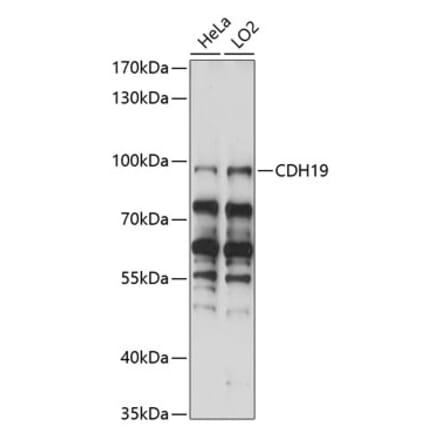 Western Blot - Anti-CDH19 Antibody (A91422) - Antibodies.com