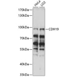 Western Blot - Anti-CDH19 Antibody (A91422) - Antibodies.com