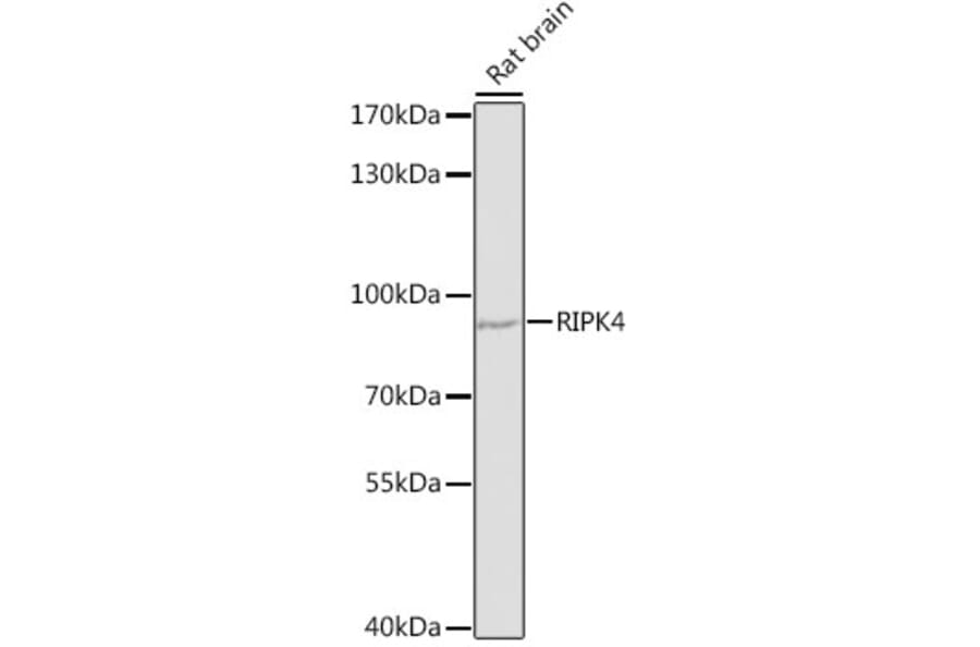 Western Blot - Anti-RIPK4 Antibody (A12580) - Antibodies.com
