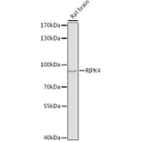 Western Blot - Anti-RIPK4 Antibody (A12580) - Antibodies.com
