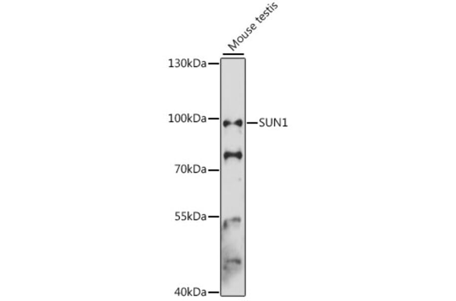 Western Blot - Anti-SUN1 Antibody (A91425) - Antibodies.com
