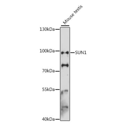 Western Blot - Anti-SUN1 Antibody (A91425) - Antibodies.com