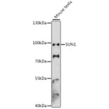 Western Blot - Anti-SUN1 Antibody (A91425) - Antibodies.com