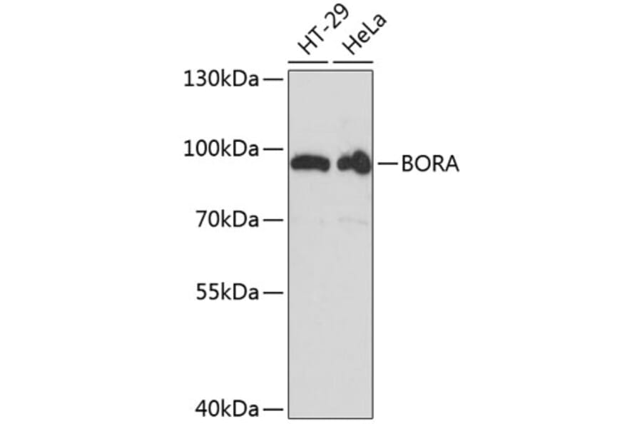 Western Blot - Anti-Bora Antibody (A91426) - Antibodies.com