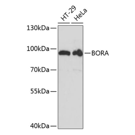 Western Blot - Anti-Bora Antibody (A91426) - Antibodies.com