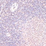 Immunohistochemistry - Anti-HSF1 Antibody (A91427) - Antibodies.com