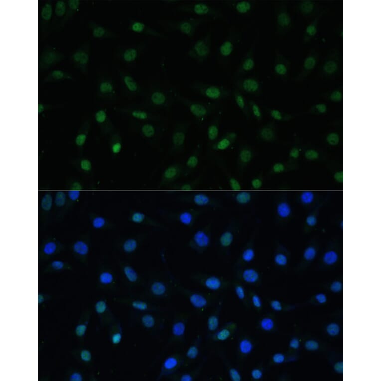 Immunofluorescence - Anti-HSF1 Antibody (A91427) - Antibodies.com