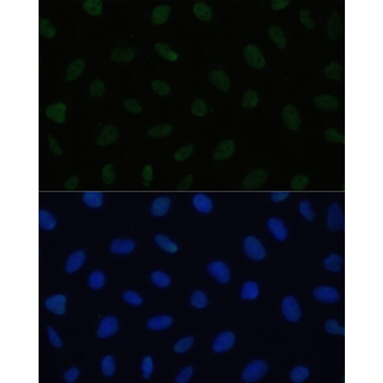 Immunofluorescence - Anti-HSF1 Antibody (A91427) - Antibodies.com