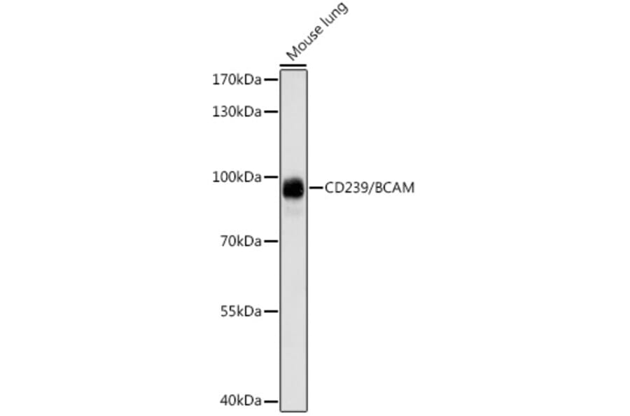 Western Blot - Anti-CD239/BCAM Antibody (A91428) - Antibodies.com