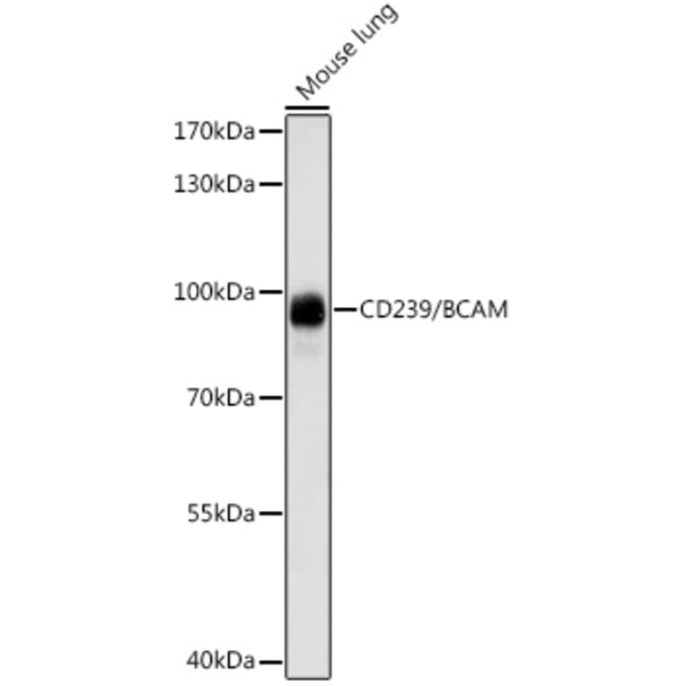 Western Blot - Anti-CD239/BCAM Antibody (A91428) - Antibodies.com