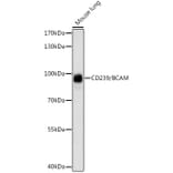 Western Blot - Anti-CD239/BCAM Antibody (A91428) - Antibodies.com