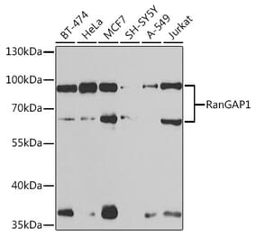 Western Blot - Anti-RanGAP1 Antibody (A91429) - Antibodies.com