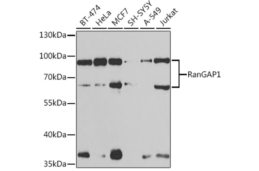 Western Blot - Anti-RanGAP1 Antibody (A91429) - Antibodies.com