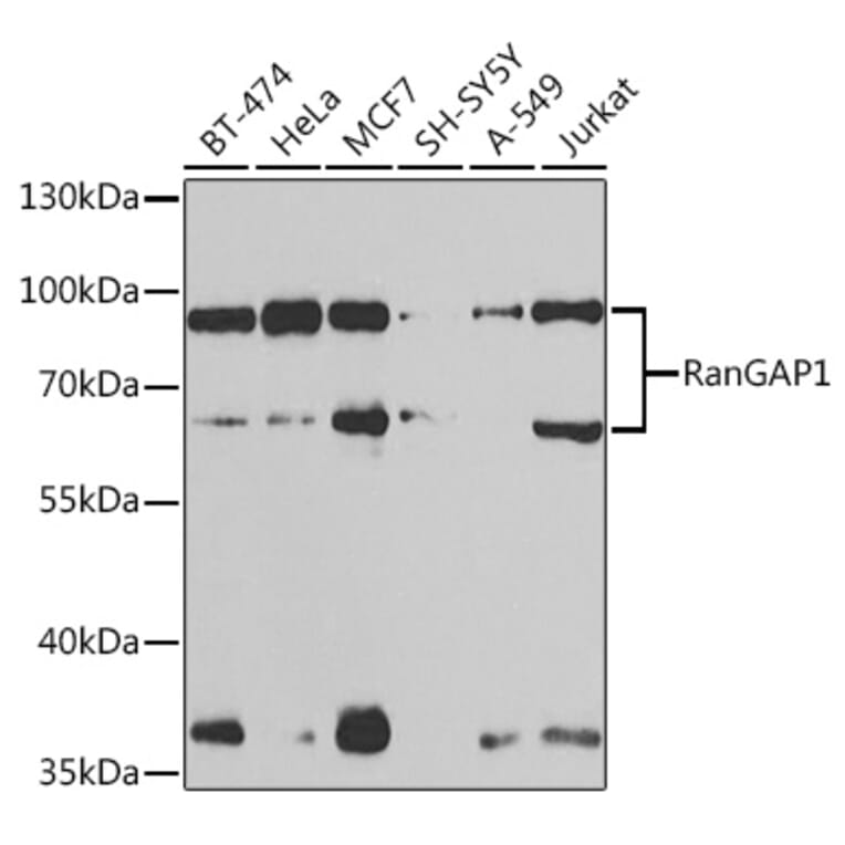 Western Blot - Anti-RanGAP1 Antibody (A91429) - Antibodies.com