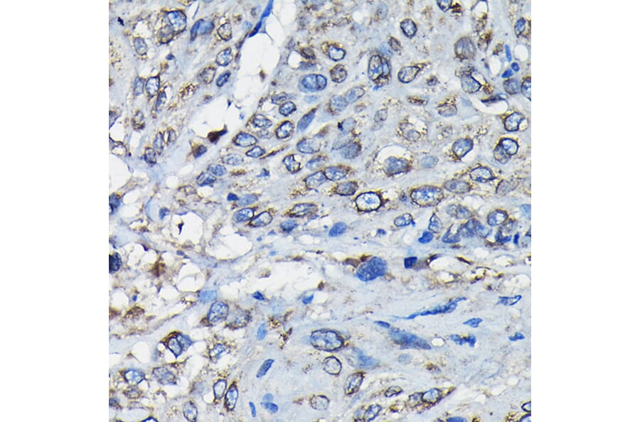 Immunohistochemistry - Anti-RanGAP1 Antibody (A91429) - Antibodies.com