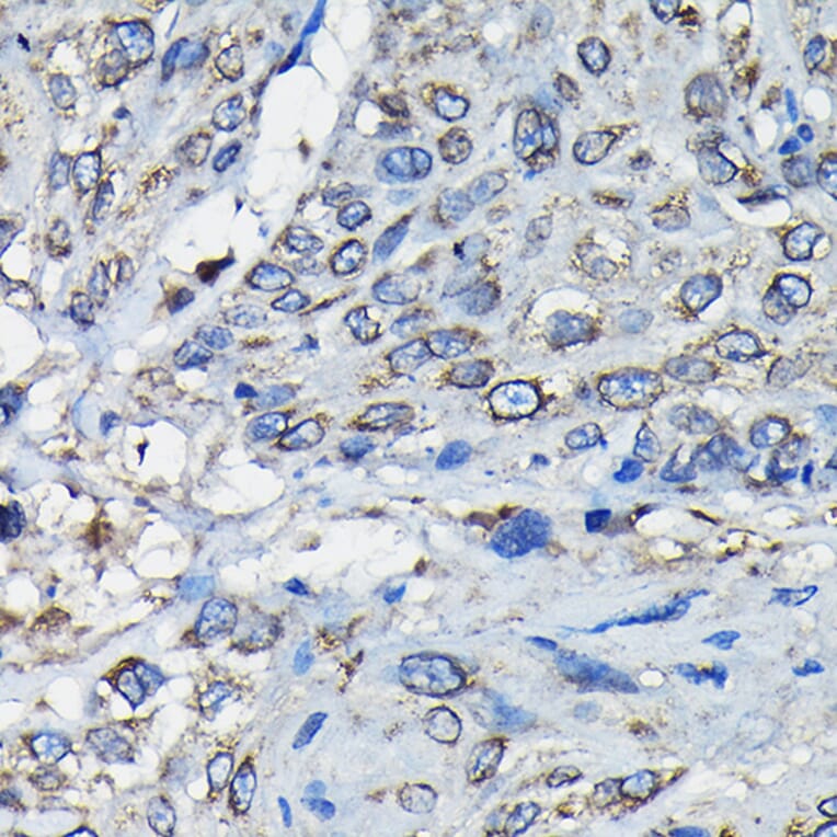 Immunohistochemistry - Anti-RanGAP1 Antibody (A91429) - Antibodies.com